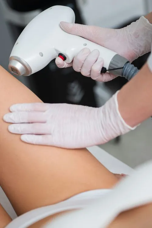 Laser vs IPL – kumba depilatsiooni valida ja miks?